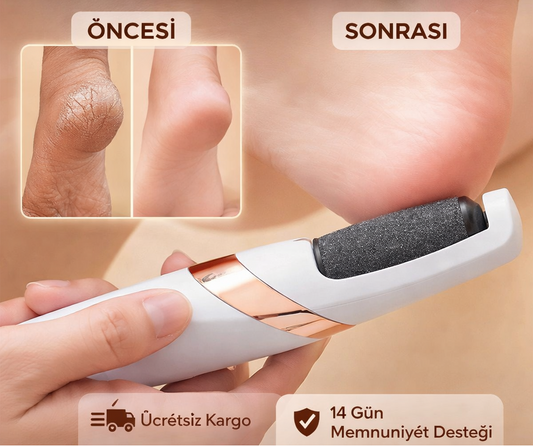 Profesyonel Şarjlı Topuk Bakım Cihazı